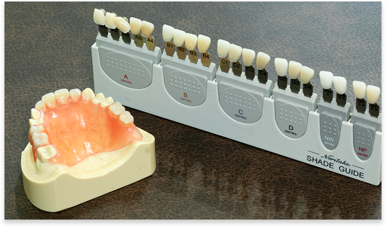 なるべく短期間で詰め物や被せ物などを作製